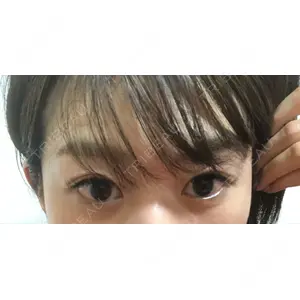 APOLLO BEAUTY CLINIC口コミ