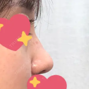 グローバルビューティークリニック 東京院の