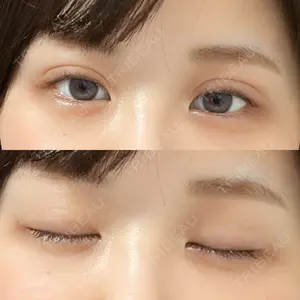TCB東京中央美容外科 上野院の
