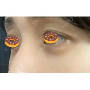 APOLLO BEAUTY CLINIC口コミ
