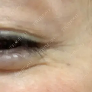 湘南美容クリニック 湘南美容クリニック 東京蒲田院口コミ