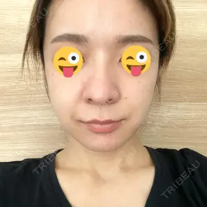 TCB東京中央美容外科 TCB東京中央美容外科 新宿三丁目院口コミ