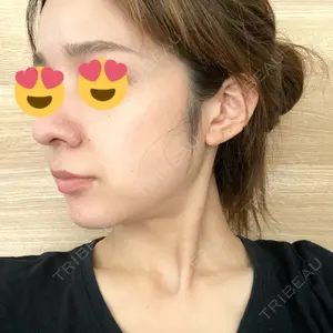 TCB東京中央美容外科 TCB東京中央美容外科 新宿三丁目院口コミ