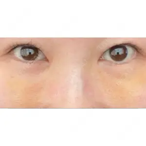 APOLLO BEAUTY CLINIC口コミ