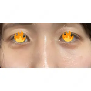 APOLLO BEAUTY CLINIC口コミ