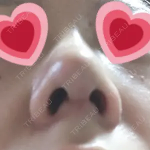 口コミ
