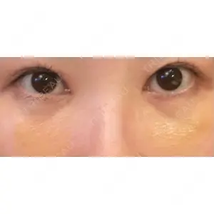 APOLLO BEAUTY CLINIC口コミ