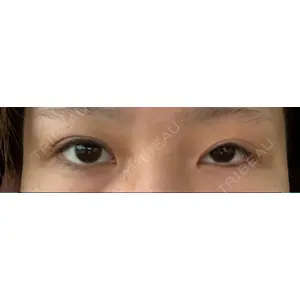 口コミ