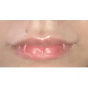 聖心美容クリニック グループ 聖心美容クリニック 六本木院口コミ