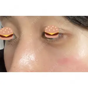 APOLLO BEAUTY CLINIC口コミ