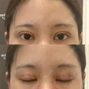 東京BELLEZZAクリニック口コミ