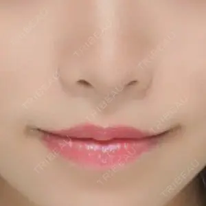 東京皮膚科・形成外科 東京皮膚科・形成外科 (銀座いけだクリニック)口コミ