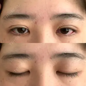 東京BELLEZZAクリニック口コミ
