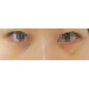APOLLO BEAUTY CLINIC口コミ