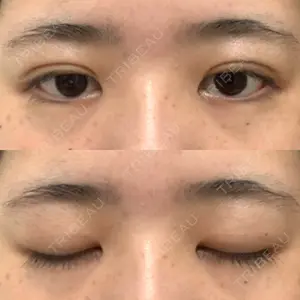 東京BELLEZZAクリニック口コミ