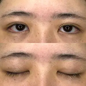 東京BELLEZZAクリニック口コミ