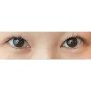 APOLLO BEAUTY CLINIC口コミ
