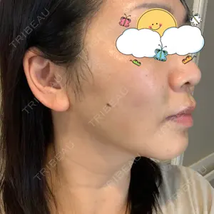 X CLINIC X CLINIC 銀座院口コミ