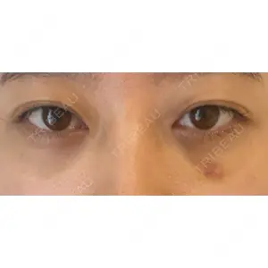 APOLLO BEAUTY CLINIC口コミ