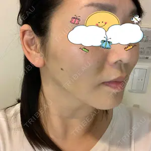 X CLINIC X CLINIC 銀座院口コミ