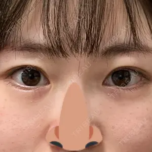口コミ