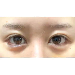 APOLLO BEAUTY CLINIC口コミ