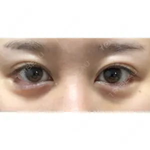 APOLLO BEAUTY CLINIC口コミ