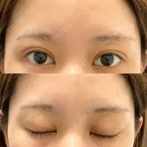 東京BELLEZZAクリニック口コミ