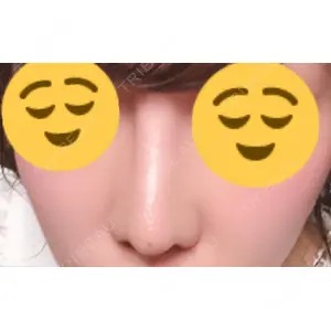 オペラ整形外科口コミ