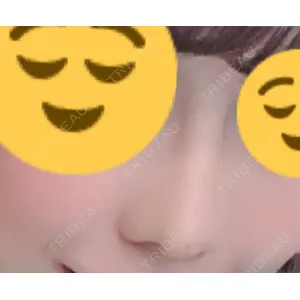 オペラ整形外科口コミ