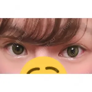 オペラ整形外科口コミ