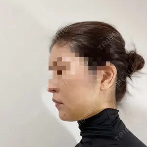 湘南美容クリニック 湘南美容クリニック 秋葉原院口コミ