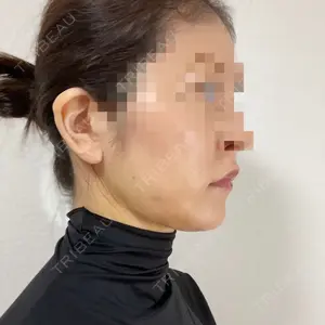 湘南美容クリニック 湘南美容クリニック 秋葉原院口コミ