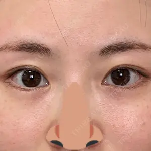 口コミ