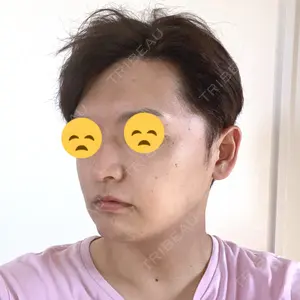 オペラ整形外科口コミ