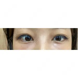 APOLLO BEAUTY CLINIC口コミ
