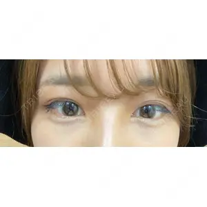APOLLO BEAUTY CLINIC口コミ