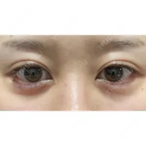 APOLLO BEAUTY CLINIC口コミ