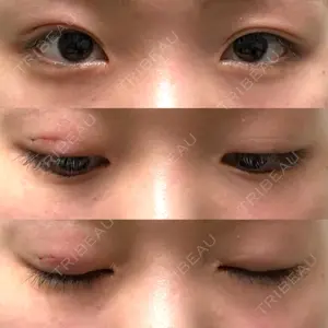 R.O.clinic口コミ