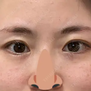 口コミ