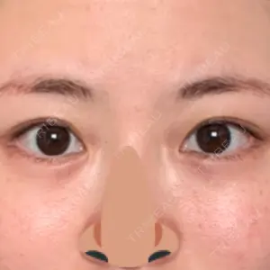 口コミ
