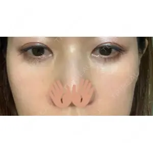 口コミ