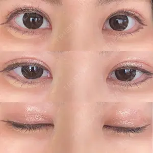 口コミ