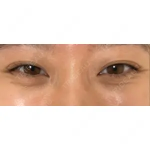 APOLLO BEAUTY CLINIC口コミ