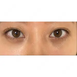 APOLLO BEAUTY CLINIC口コミ
