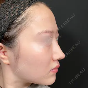 Zetith Beauty Clinic Zetith Beauty Clinic 銀座院口コミ
