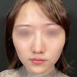 Zetith Beauty Clinic Zetith Beauty Clinic 銀座院口コミ