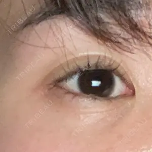 APOLLO BEAUTY CLINIC口コミ