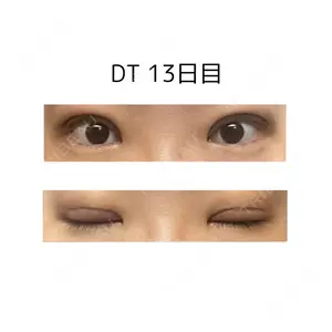 口コミ