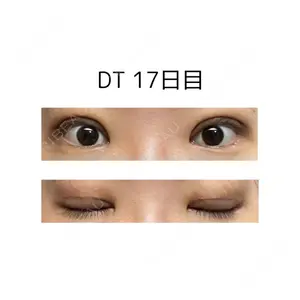 口コミ